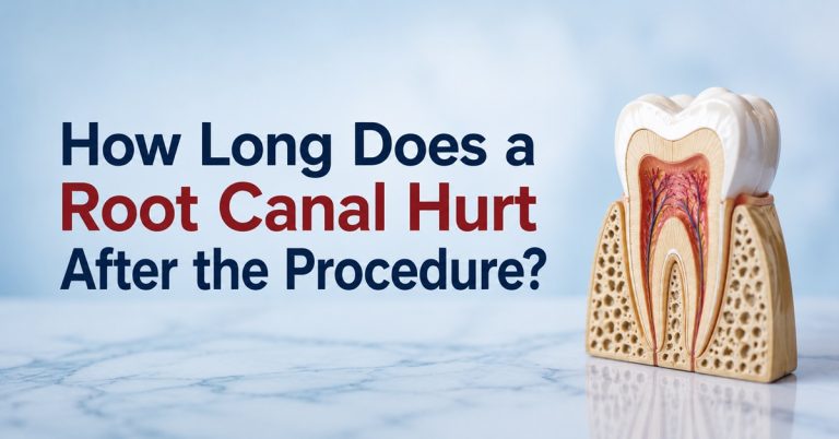 How Long Does a Root Canal Hurt After the Procedure